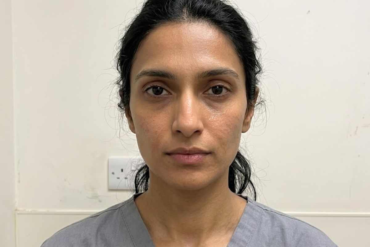 After treatment